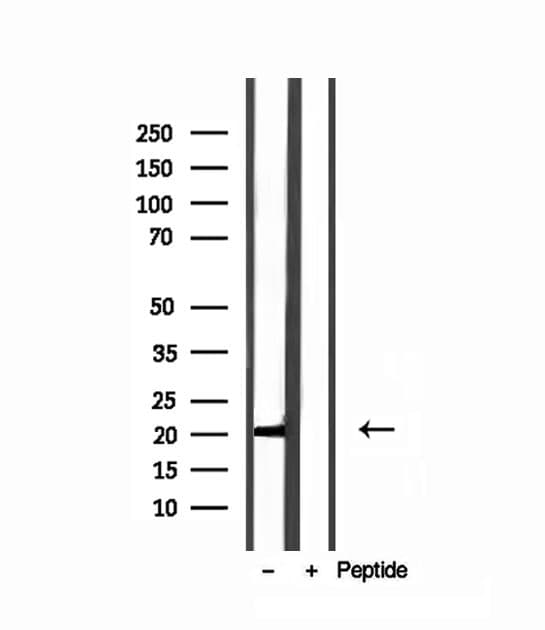 MPV17 Antibody