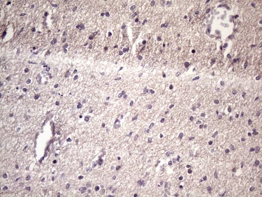 HSF2 Antibody (aa74-324, clone OTI2E11)