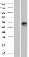 KRT25 / Keratin 25 Protein (Over-Expression Lysate Myc-DDK (Flag))