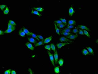 Polyclonal Rabbit anti-Human CDKAL1 Antibody (IHC, IF)