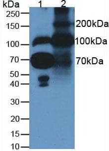 FBLN1 / Fibulin 1 Antibody (clone C6)