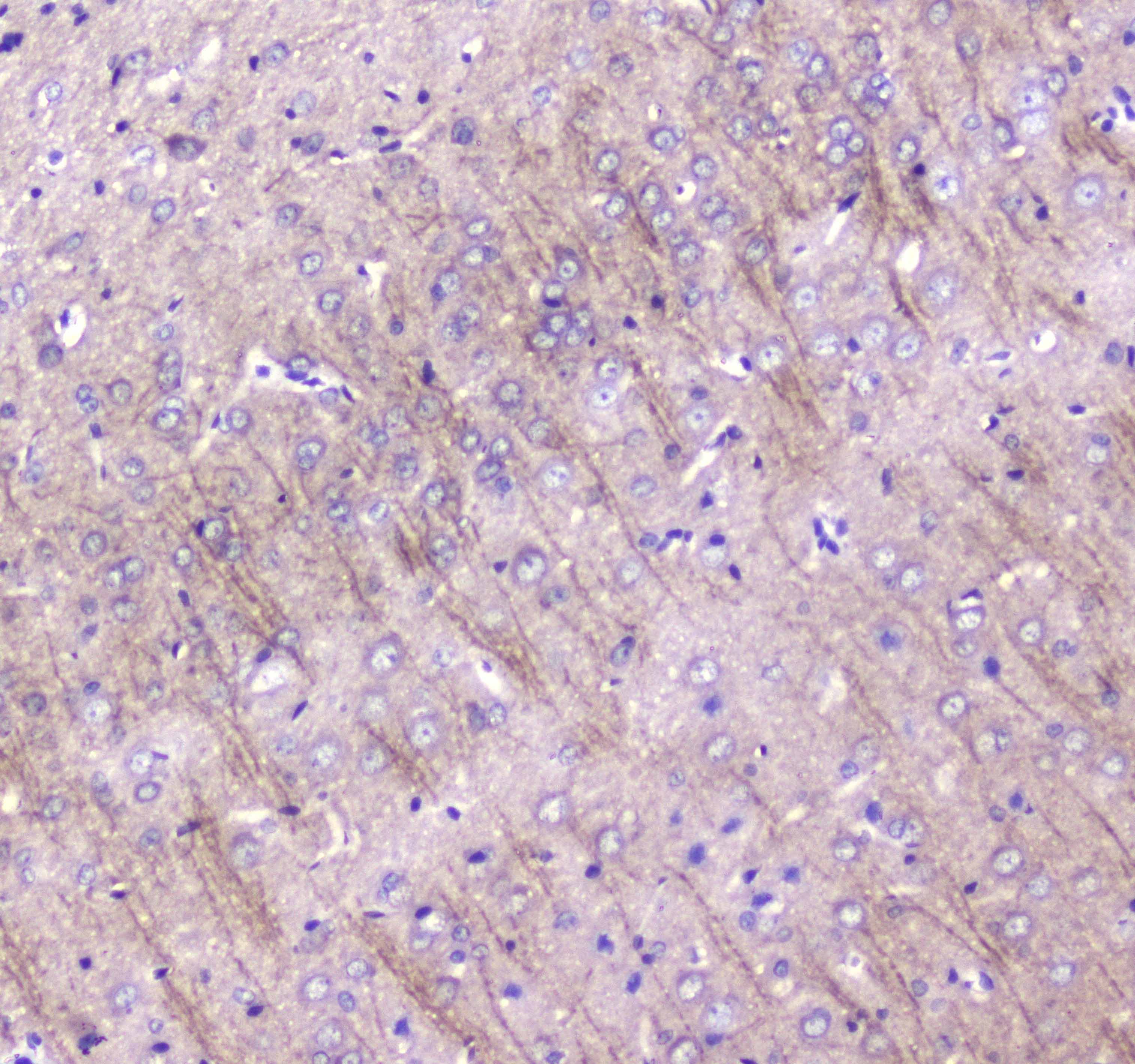 MAP1LC3A / LC3A Antibody