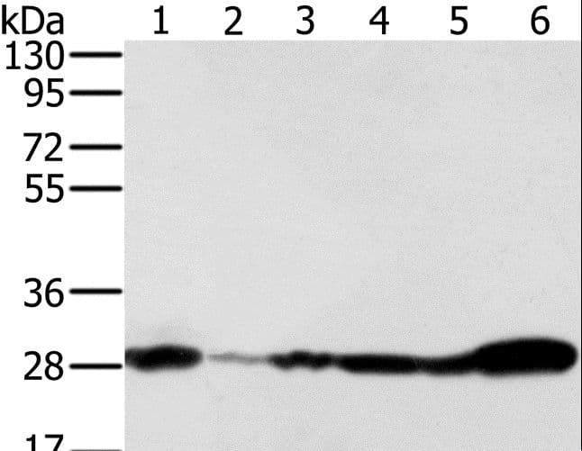 Polyclonal Rabbit anti-Human NDUFS3 Antibody (IHC, WB)
