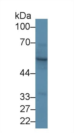 KRT15 / CK15 / Cytokeratin 15 Antibody (aa94-402)