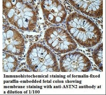 ASTN2 Antibody (aa134-321)