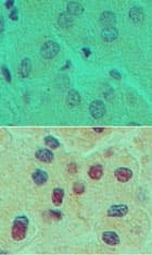ONECUT1 / HNF6 Antibody (aa420-470)