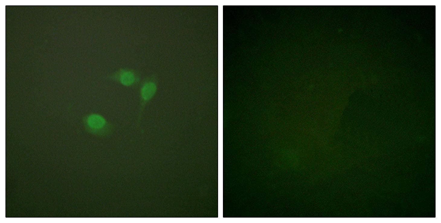 SUMO1 / SMT3 Antibody