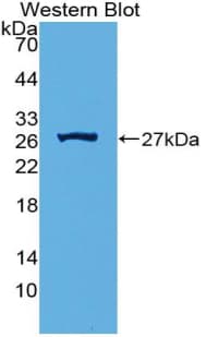 Complement C1QA Antibody (aa23-245, Cy3)