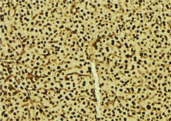 PRPF3 Antibody