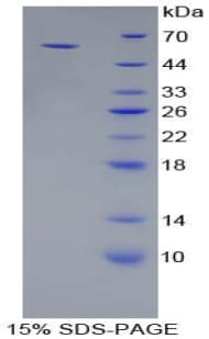 Pig CDH1 / E Cadherin Protein (Recombinant His-GST)