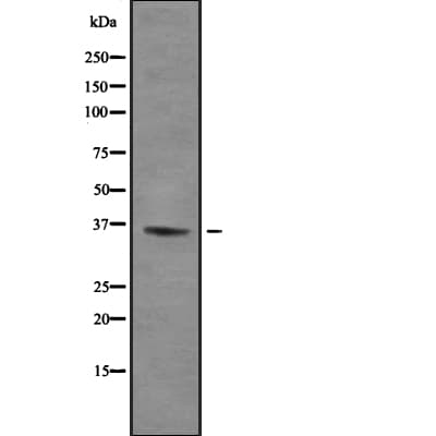 Polyclonal Rabbit anti-Human ZFP36L1 Antibody (IF, WB)