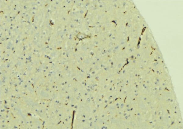 Polyclonal Rabbit anti-Human PREX1 / P-REX1 Antibody (IHC, WB)