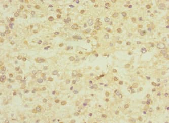 E4 / UBE4A Antibody