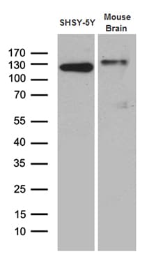 DBN1 / Drebrin Antibody (aa2-240, clone OTI4G4)