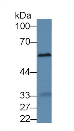 A1BG Antibody (aa220-415, HRP)