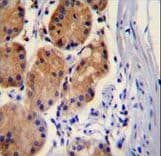 CTNNB1 / Beta Catenin Antibody (aa646-673)