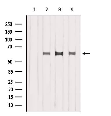 ISYNA1 Antibody