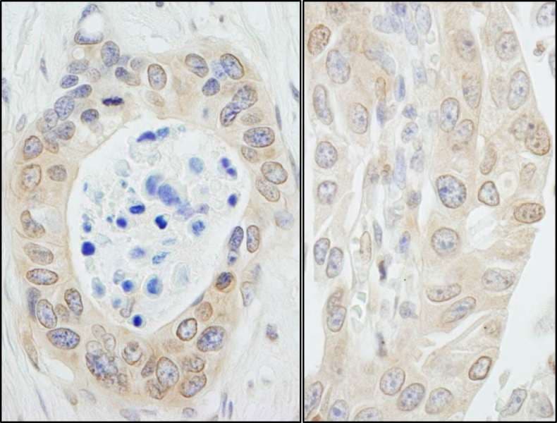 Polyclonal Rabbit anti-Human NMI Antibody (aa250-C-term, IHC, WB)