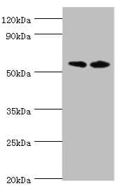 PLAP / Alkaline Phosphatase Antibody (aa260-520)