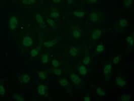 ARNT / HIF-1-Beta Antibody (clone OTI2C7)