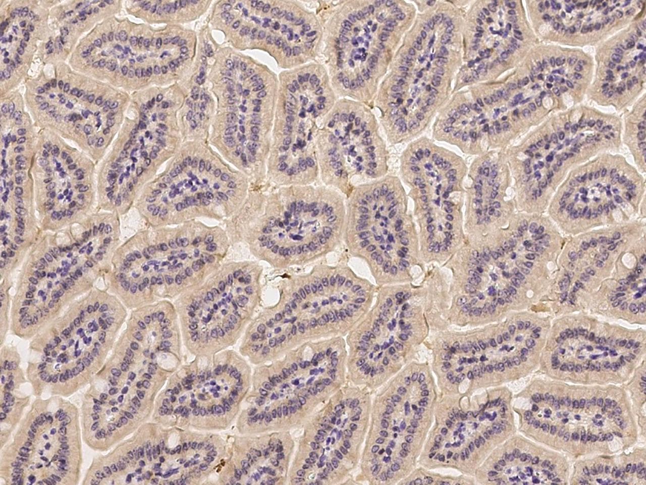 Polyclonal Rabbit anti-Mouse IL1R1 Antibody (Preservative Free, IHC)