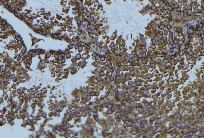 Polyclonal Rabbit anti-Human MAPT / Tau Antibody (IHC, WB)