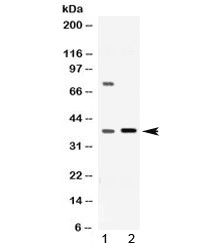 Polyclonal Rabbit anti-Human Dihydrodiol Dehydrogenase / AKR1C1 / AKR1C2 Antibody (WB)