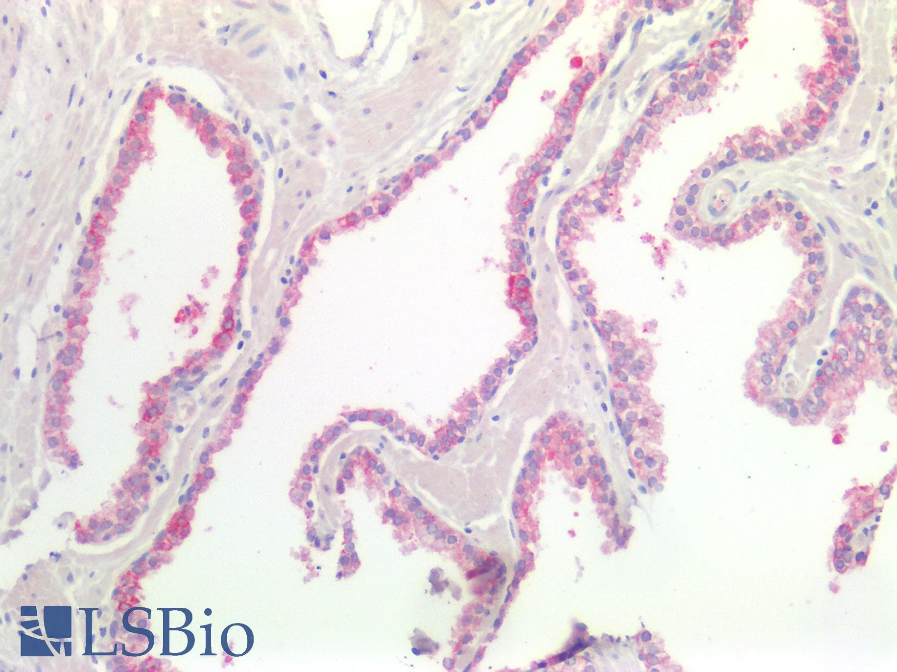 PathPlus™ Polyclonal Rabbit anti-Human FOLR1 / Folate Receptor Alpha Antibody (IHC)