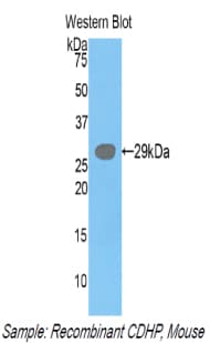 CDH3 / P-Cadherin Antibody (aa154-394)