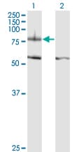 ITGB8 / Integrin Beta 8 Antibody (clone 2B4)