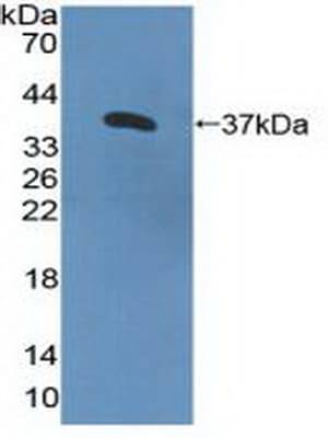 CXCR2 Antibody