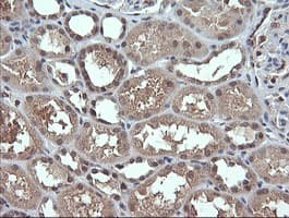 DDX58 / RIG-1 / RIG-I Antibody (clone OTI8D2)