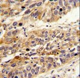 LRG1 / LRG Antibody (aa194-223)