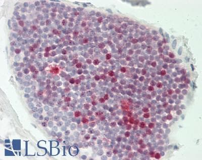 IHC-plus™ Monoclonal Mouse anti-Human LGALS9 / Galectin 9 Antibody (clone 1G3, IHC, WB)