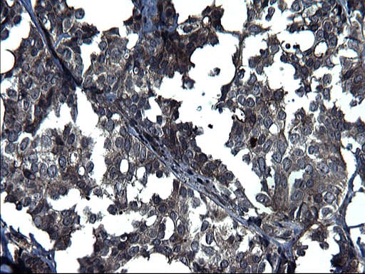 ANKMY2 Antibody (clone OTI1F11)