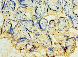 TROP2 / TACSTD2 Antibody (aa27-270)