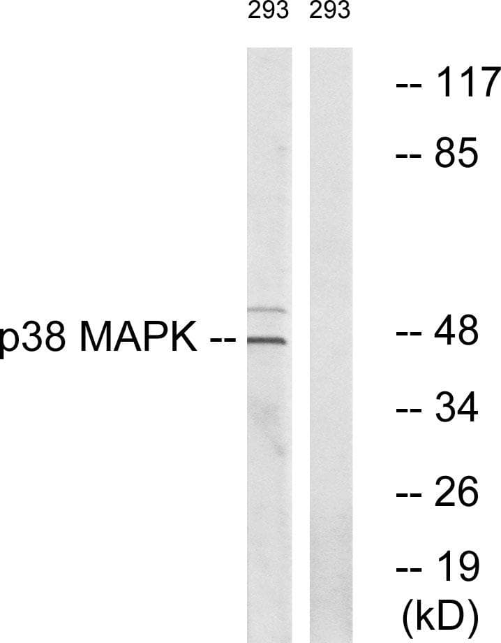 MAPK14 / p38 Antibody (p322)