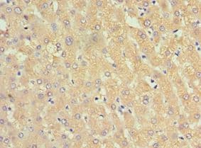 Alpha-1-Antichymotrypsin Antibody (aa24-423)