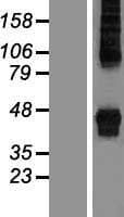 ZDHHC14 Protein (Over-Expression Lysate Myc-DDK (Flag))