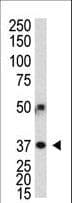 ATG3 Antibody (aa2-31)