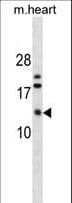 Polyclonal Rabbit anti-Human FXYD7 Antibody (aa1-30, WB)