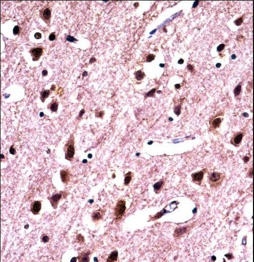 SNRPN Antibody (aa34-62)