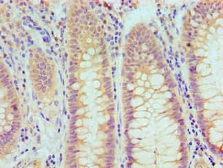 TP53 / p53 Antibody (clone 6H5E7)