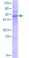 Human EMD / Emerin Protein (Recombinant GST)