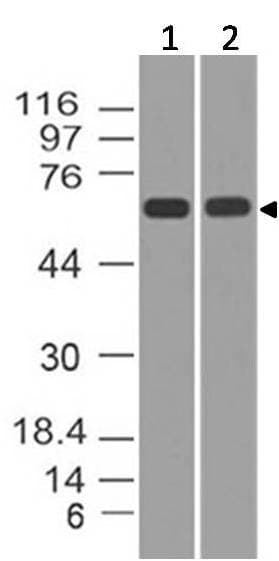 TP73 / p73 Antibody