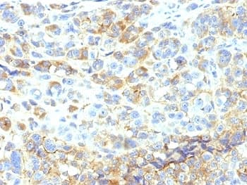 ICAM-1 / CD54 Antibody (clone 1H4 or W-CAM-1 or Wehi-CAM-1, Ready-to-Use)