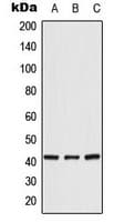 Polyclonal Rabbit anti-Human CRK Antibody (Internal, IHC, WB)