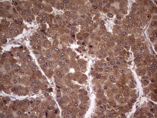 BFSP2 Antibody (aa184-415, clone OTI4E7, Carrier-free)