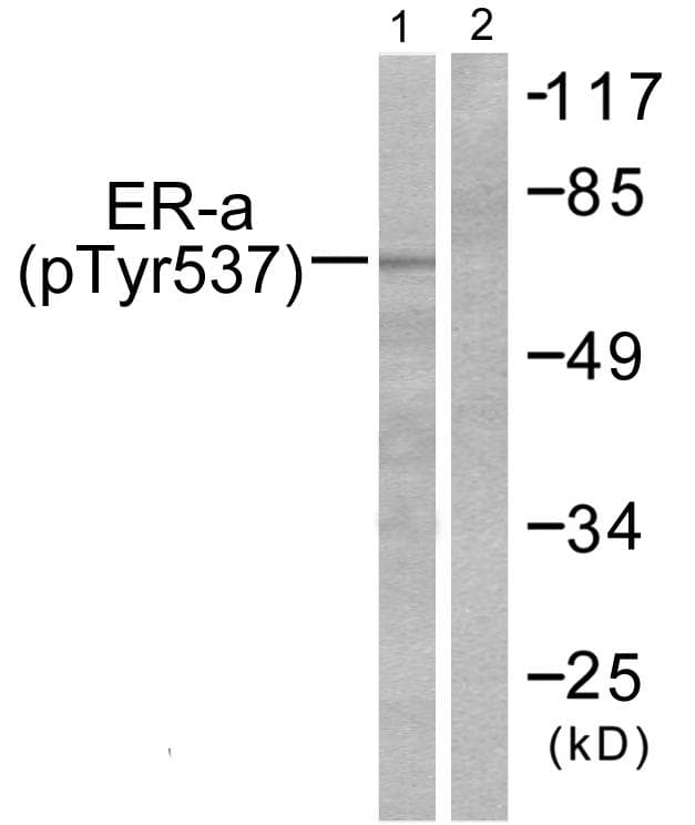 ER Alpha / Estrogen Receptor Antibody (phospho-Tyr537)