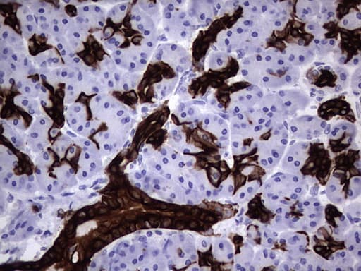 KRT19 / CK19 / Cytokeratin 19 Antibody (aa240-390, clone OTI3D10)